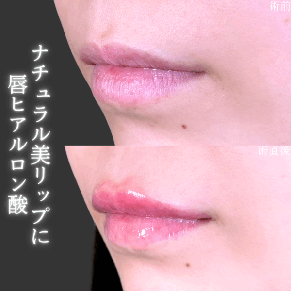 No.9226の症例写真